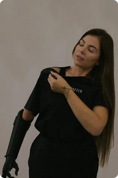 Woman wearing a prosthetic arm opens collar of t shirt for ease of dressing